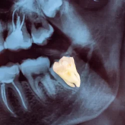 nho rang khon_4_11zon